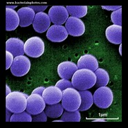 VISA electron microscopy, SEM